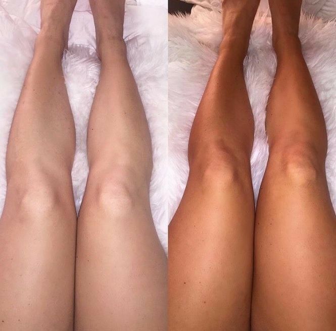 Image #1 from Keira Young